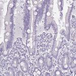 Thyroglobulin Antibody in Immunohistochemistry (Paraffin) (IHC (P))