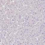 Thyroglobulin Antibody in Immunohistochemistry (Paraffin) (IHC (P))