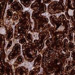 Thyroglobulin Antibody in Immunohistochemistry (Paraffin) (IHC (P))
