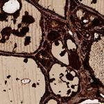 Thyroglobulin Antibody in Immunohistochemistry (Paraffin) (IHC (P))