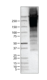 Thyroglobulin Antibody in Western Blot (WB)