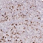 ATAD2 Antibody in Immunohistochemistry (Paraffin) (IHC (P))