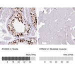 ATAD2 Antibody in Immunohistochemistry (Paraffin) (IHC (P))