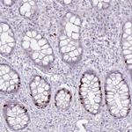 ATAD2 Antibody in Immunohistochemistry (Paraffin) (IHC (P))