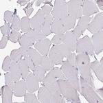 ATAD2 Antibody in Immunohistochemistry (Paraffin) (IHC (P))