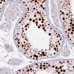 ATAD2 Antibody in Immunohistochemistry (Paraffin) (IHC (P))