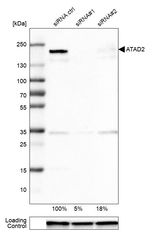 ATAD2 Antibody in Western Blot (WB)