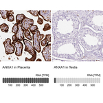 Annexin A1 Antibody in Immunohistochemistry (Paraffin) (IHC (P))