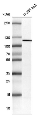 NLRP3 Antibody in Western Blot (WB)