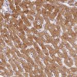 SLC27A5 Antibody in Immunohistochemistry (Paraffin) (IHC (P))