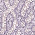 SLC27A5 Antibody in Immunohistochemistry (Paraffin) (IHC (P))