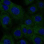 IDH1 Monoclonal Antibody (CL0219)