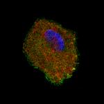 S100A4 Monoclonal Antibody (CL0237)