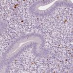 S100A4 Antibody in Immunohistochemistry (Paraffin) (IHC (P))