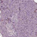 S100A4 Antibody in Immunohistochemistry (Paraffin) (IHC (P))
