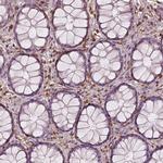 S100A4 Antibody in Immunohistochemistry (Paraffin) (IHC (P))