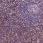 S100A4 Antibody in Immunohistochemistry (Paraffin) (IHC (P))