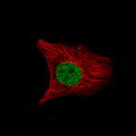 SATB2 Monoclonal Antibody (CL0320)