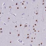SATB2 Antibody in Immunohistochemistry (Paraffin) (IHC (P))