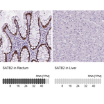 SATB2 Antibody in Immunohistochemistry (Paraffin) (IHC (P))