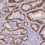 SATB2 Antibody in Immunohistochemistry (Paraffin) (IHC (P))