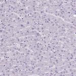 SATB2 Antibody in Immunohistochemistry (Paraffin) (IHC (P))
