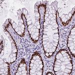 SATB2 Antibody in Immunohistochemistry (Paraffin) (IHC (P))