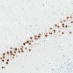 SATB2 Antibody in Immunohistochemistry (Paraffin) (IHC (P))