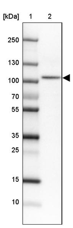 SATB2 Antibody in Western Blot (WB)