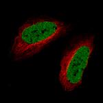 SATB2 Monoclonal Antibody (CL0323)