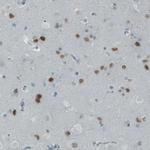 SATB2 Antibody in Immunohistochemistry (Paraffin) (IHC (P))
