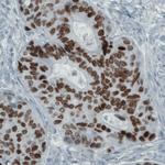 SATB2 Antibody in Immunohistochemistry (Paraffin) (IHC (P))
