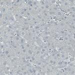SATB2 Antibody in Immunohistochemistry (Paraffin) (IHC (P))