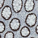 SATB2 Antibody in Immunohistochemistry (Paraffin) (IHC (P))