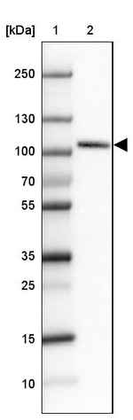 SATB2 Antibody in Western Blot (WB)