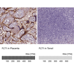 VEGF Receptor 1 Antibody in Immunohistochemistry (Paraffin) (IHC (P))