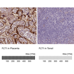 VEGF Receptor 1 Antibody in Immunohistochemistry (Paraffin) (IHC (P))