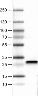 SDHB Antibody in Western Blot (WB)