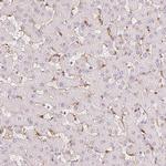 CD206 Antibody in Immunohistochemistry (Paraffin) (IHC (P))