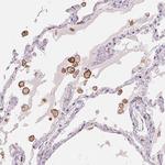 CD206 Antibody in Immunohistochemistry (Paraffin) (IHC (P))