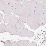 CD206 Antibody in Immunohistochemistry (Paraffin) (IHC (P))