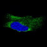 Metadherin Monoclonal Antibody (CL0397)
