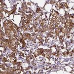 Metadherin Antibody in Immunohistochemistry (Paraffin) (IHC (P))