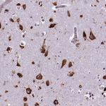 Metadherin Antibody in Immunohistochemistry (Paraffin) (IHC (P))