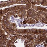 Metadherin Antibody in Immunohistochemistry (Paraffin) (IHC (P))