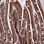 Metadherin Antibody in Immunohistochemistry (Paraffin) (IHC (P))
