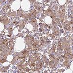 Metadherin Antibody in Immunohistochemistry (Paraffin) (IHC (P))