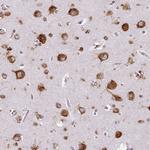 Metadherin Antibody in Immunohistochemistry (Paraffin) (IHC (P))