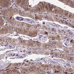Metadherin Antibody in Immunohistochemistry (Paraffin) (IHC (P))