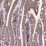 Metadherin Antibody in Immunohistochemistry (Paraffin) (IHC (P))
